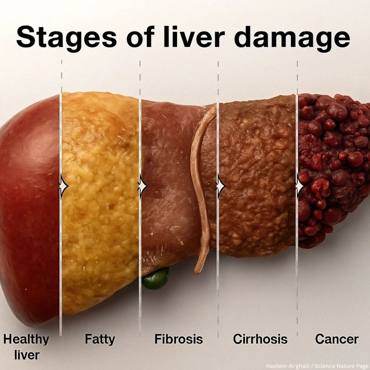 HEALYN™ Milk Thistle (3 month Supply)